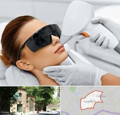 مرکز لیزر مو در دزاشیب
