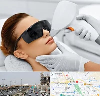 مرکز لیزر مو در بلوار توس مشهد