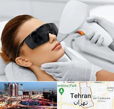 مرکز لیزر موهای زائد در صادقیه