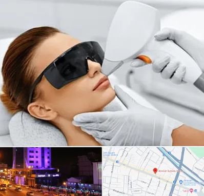 مرکز لیزر مو در آبرسان تبریز