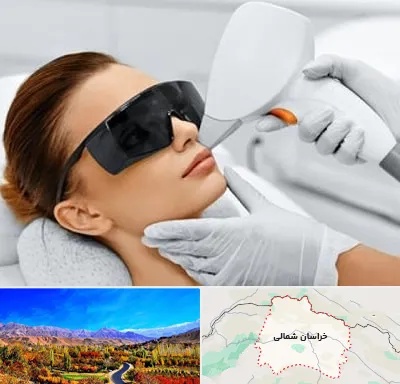 مرکز لیزر مو در خراسان شمالی