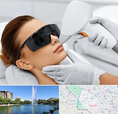 مرکز لیزر مو در کوهسنگی مشهد