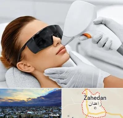 مرکز لیزر مو در زاهدان