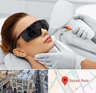 مرکز لیزر مو در بازار رضا مشهد