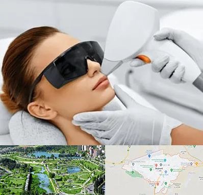 مرکز لیزر مو در بجنورد