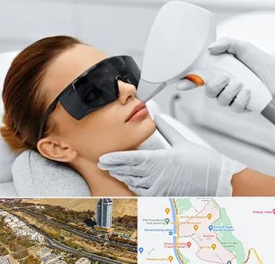 مرکز لیزر مو در خیابان نیایش شیراز