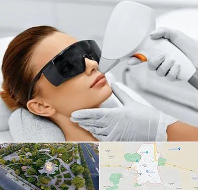 مرکز لیزر مو در کاشمر