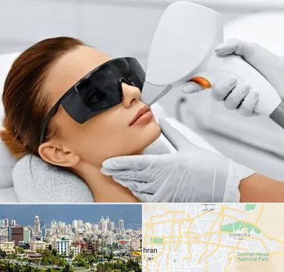 مرکز لیزر مو در شرق تهران