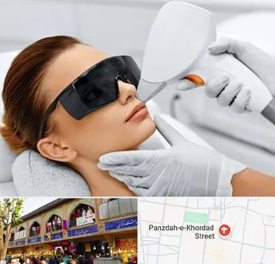 مرکز لیزر مو در 15 خرداد