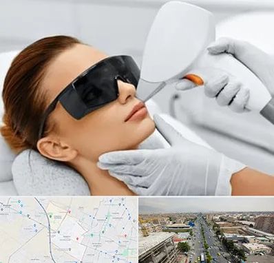 مرکز لیزر مو در حصارک کرج