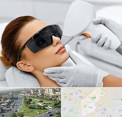 مرکز لیزر مو در کمال شهر کرج