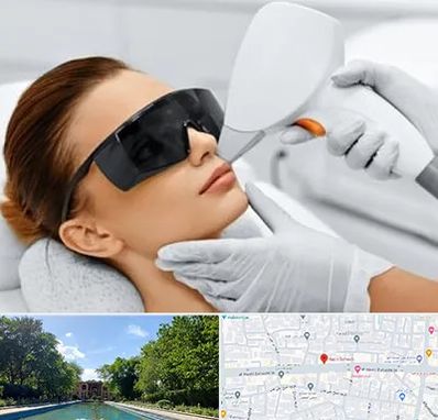 مرکز لیزر مو در هشت بهشت اصفهان