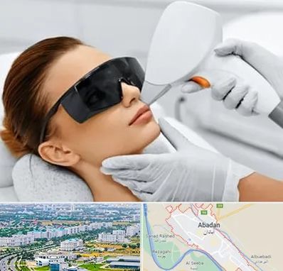 مرکز لیزر مو در آبادان
