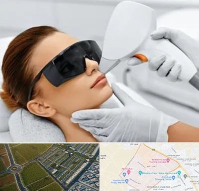 مرکز لیزر مو در الهیه مشهد