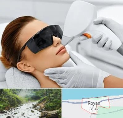 مرکز لیزر مو در رویان
