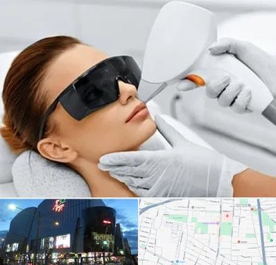 مرکز لیزر مو در بلوار اباذر