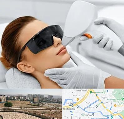 مرکز لیزر مو در کوی وحدت شیراز