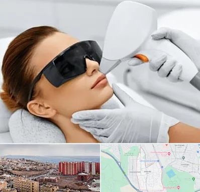 مرکز لیزر مو در سهند تبریز