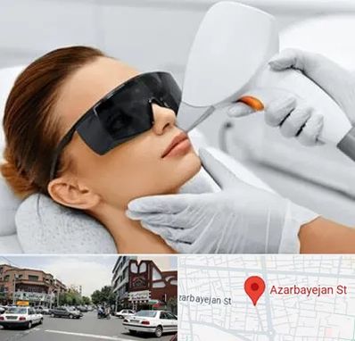 مرکز لیزر مو در خیابان آذربایجان