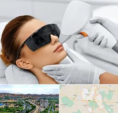 مرکز لیزر مو در شهریار