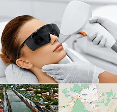 مرکز لیزر مو در مراغه