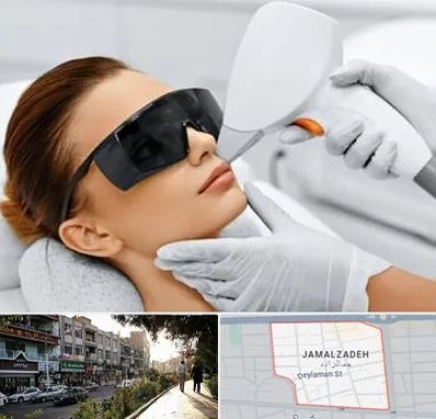 مرکز لیزر مو در خیابان جمالزاده