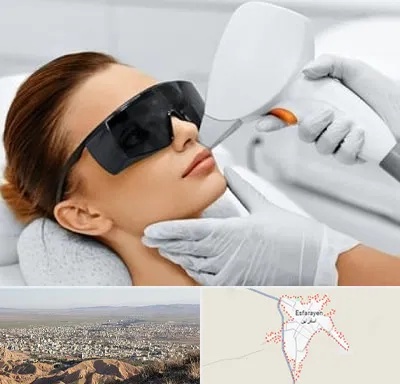 مرکز لیزر مو در اسفراین