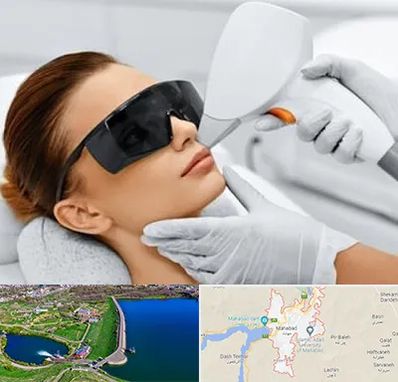 مرکز لیزر مو در مهاباد