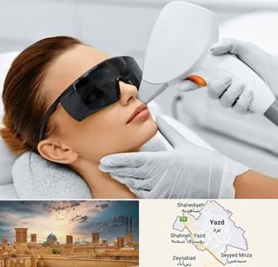 مرکز لیزر مو در یزد