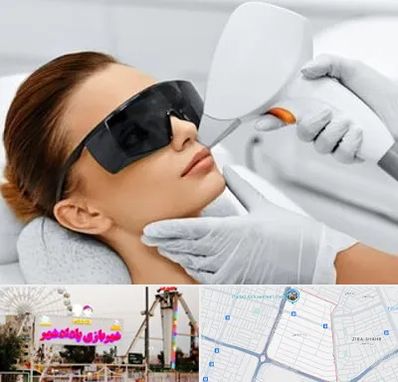مرکز لیزر مو در پادادشهر اهواز