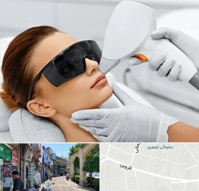 مرکز لیزر مو در خیابان قزوین