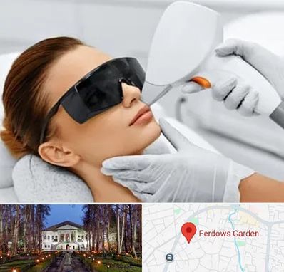 مرکز لیزر مو در باغ فردوس
