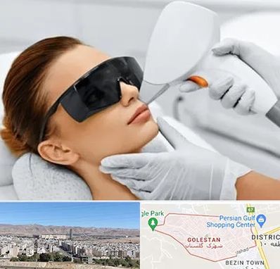 مرکز لیزر مو در شهرک گلستان شیراز