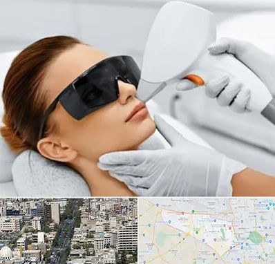 مرکز لیزر مو در منطقه 18 تهران