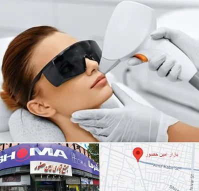 مرکز لیزر مو در امین حضور