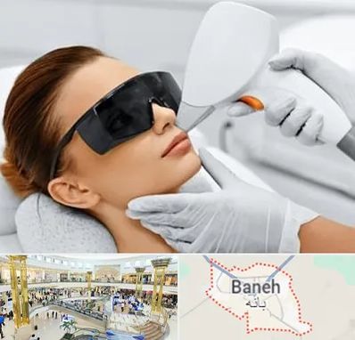 مرکز لیزر مو در بانه