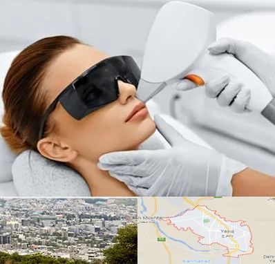 مرکز لیزر مو در یاسوج