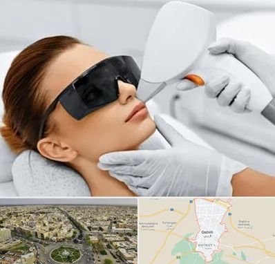 مرکز لیزر مو در قزوین