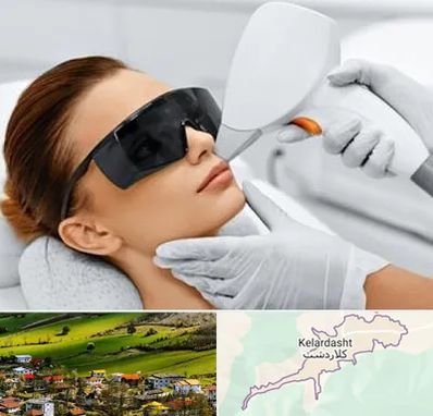مرکز لیزر مو در کلاردشت