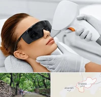 مرکز لیزر مو در شاندیز مشهد