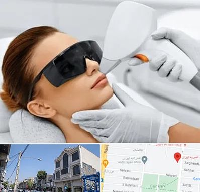 مرکز لیزر مو در افسریه