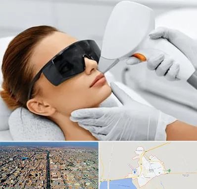 مرکز لیزر مو در بندر ماهشهر