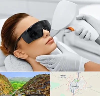 مرکز لیزر مو در کامیاران
