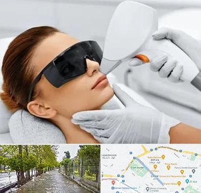 مرکز لیزر مو در خیابان ارم شیراز