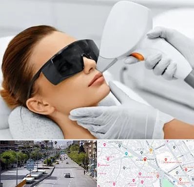 مرکز لیزر مو در خیابان زند شیراز