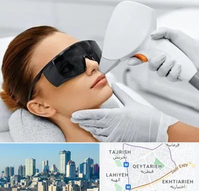 مرکز لیزر مو در قیطریه