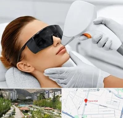 مرکز لیزر مو در بلوار تعاون