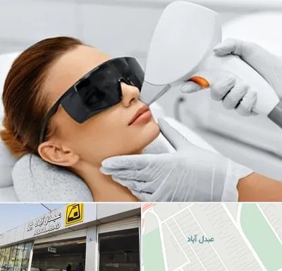 مرکز لیزر مو در عبدل آباد