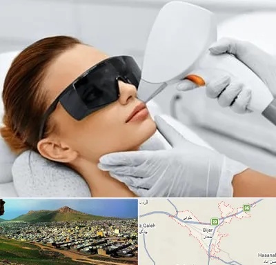 مرکز لیزر مو در بیجار