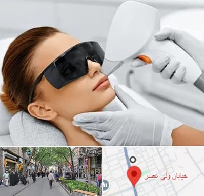 مرکز لیزر مو در ولیعصر شهریار